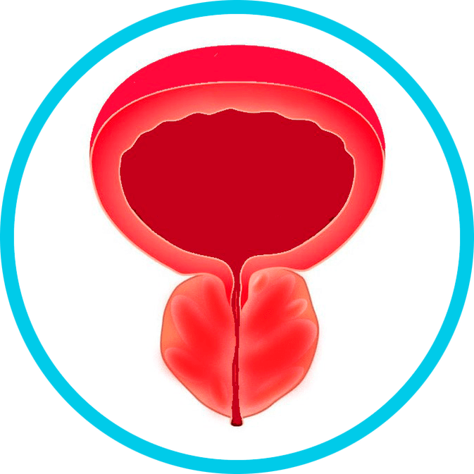 Prostatīta simptomi